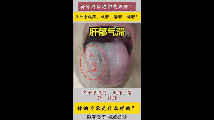 補腎終極絕招是強肝！三個中成藥，教你疏肝、清肝、補肝！ - 天天要聞