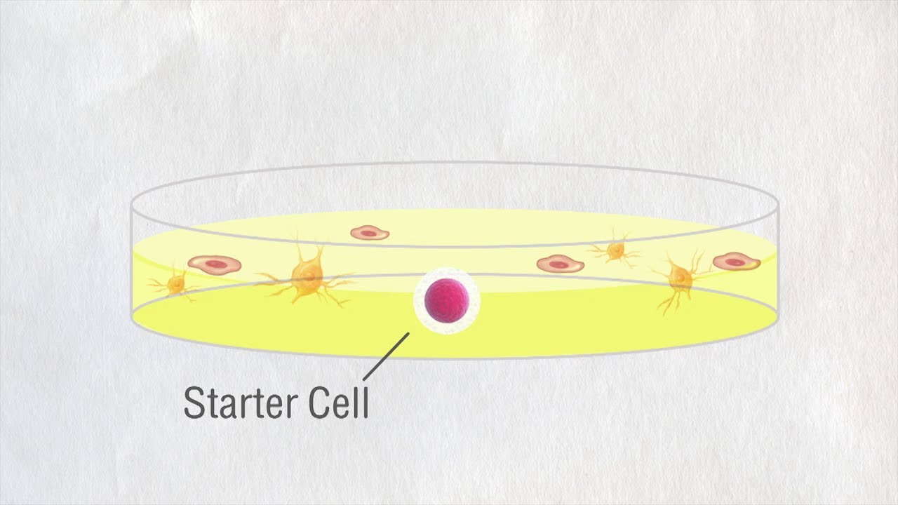 ศิริราช360° [by Mahidol] สเต็มเซลล์บริสุทธิ์ ครั้งแรกของโลก (2/2) Stem cell