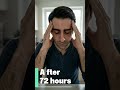 What If You Stopped Sleeping for 3 Days? #health #facts #brain