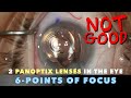 Fixing a poor result after cataract surgery  2 panoptix lenses in the same eye  iol exchange