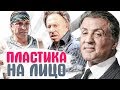 ЗНАМЕНИТОСТИ МУЖЧИНЫ, КОТОРЫЕ ДЕЛАЛИ ПЛАСТИКУ. До и после пластики