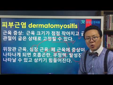 피부근염(dermatomyositis) 증상 [3]