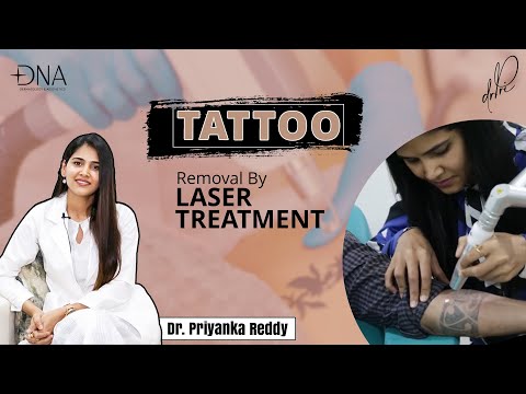 Dr. Meet's Laser Tattoo Removal In Bhopal
