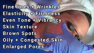 Best Hydrating Facial Glowing Skin Treatment  Hydrafacial MUST TRY!! Wealth