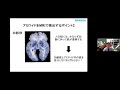 「MRIで認知症を予防する」　熊本大学　大学院生命科学研究部　先端生命医療科学部門　医療技術科学分野　准教授　米田 哲也