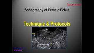 Sonography of Female Pelvis – Technique & Protocols