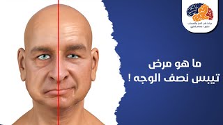 ما هو مرض تيبس نصف الوجه !