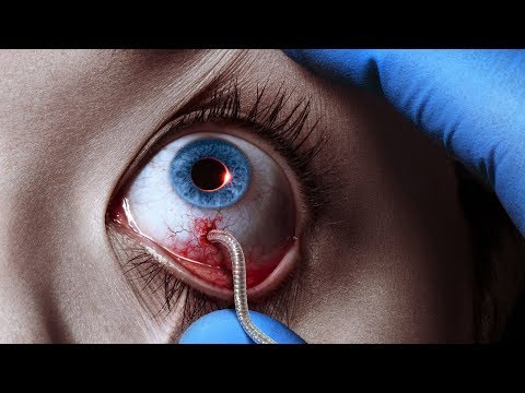 The Strain (TV Series - 2014) Season 1 Trailer