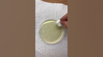 Kyle Thomas 💙 growing MICROBES 🤮🦠 imagine if we found covid... #kylethomas #shorts