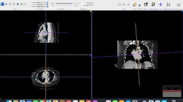DICOM viewer for Apple - Using Horos