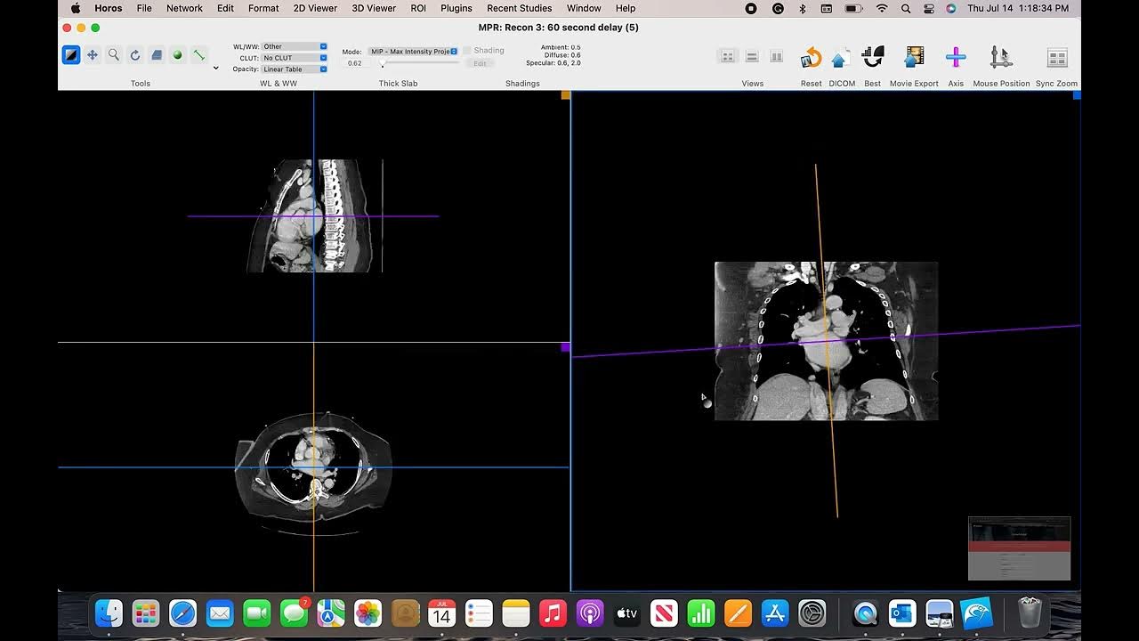 Cd viewer. Программа horos. vidar dicom viewer 3. dicom viewer комета. radiant dicom viewer ключ.