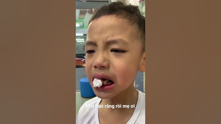 Bạn Nam đi nhổ răng và cái kết🤗