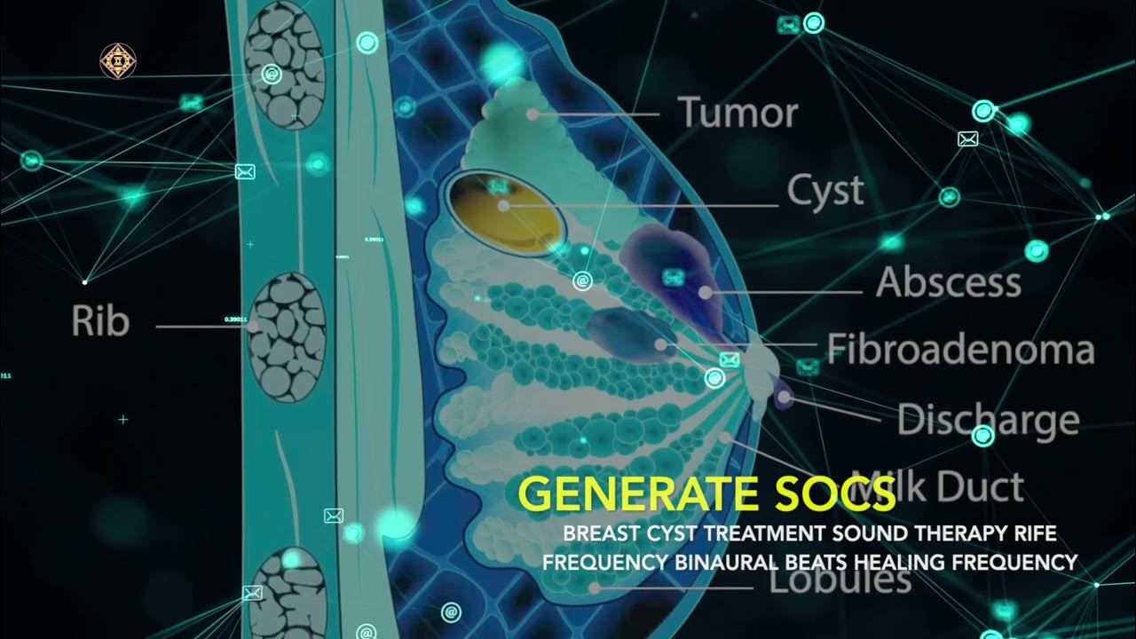 BREAST CYST TREATMENT SOUND THERAPY RIFE FREQUENCY BINAURAL BEATS