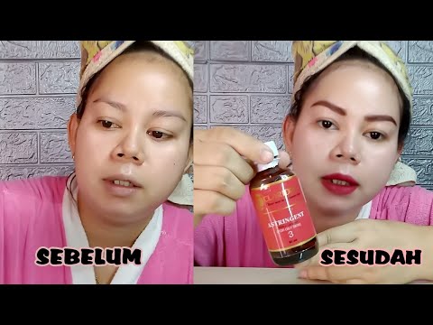 Video: Cara Mudah Menggunakan Astringent: 15 Langkah (dengan Gambar)