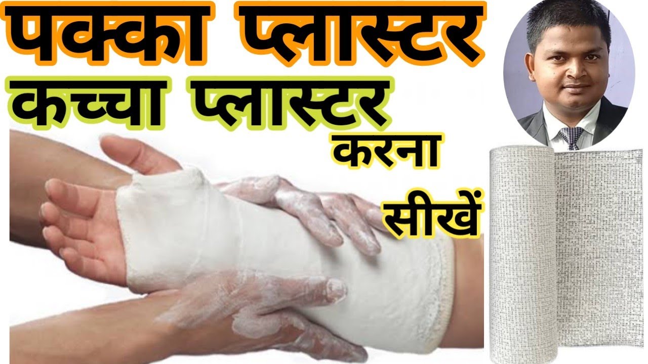 POP Bandage Kaise Use Karte Hai (कच्चा प्लास्टर,पक्का प्लास्टर करना सीखें) YouTube