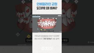 인비절라인 투명 치아교정 치료 비용은 왜 비쌀까? (치과의사 주치아🦷)