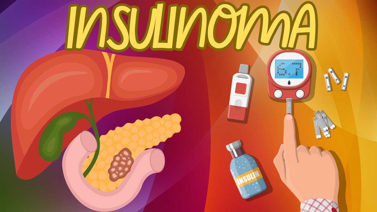 INSULINOMA