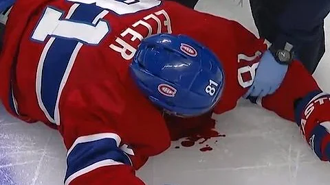 Lars Eller Injury | Montreal vs Ottawa (2013)