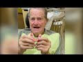 Snap On Dentures Patient Testimonial (Avenue Dental Care)