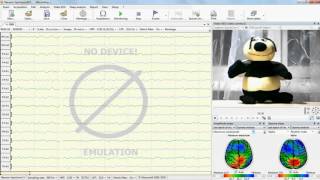 Neuron Spectrum NET  Video EEG LTM
