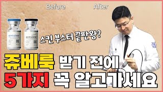 쥬베룩 받기 전에 꼭 알고 가야하는 5가지! 스킨부스터 끝판왕 쥬베룩과 쥬베룩 볼륨의 모든 것