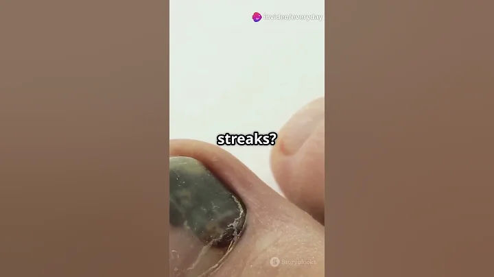 💅 Is Your Health in Your Nails 🩺 Discover the Surprising Clues They Give! #nailsswag #health #shorts