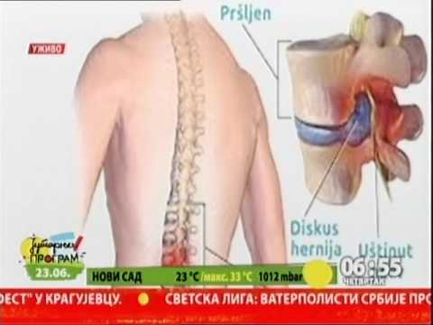 Operacija diskus hernije