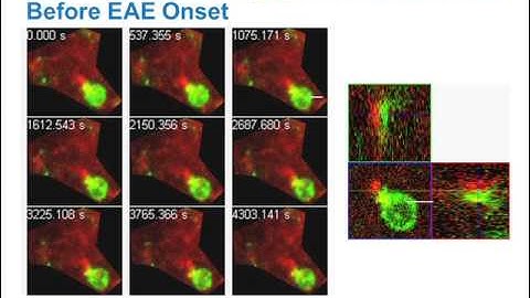 New Research on Immunology of the Cerebrospinal Fluid Compartment and MS