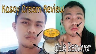 6 Days Lang Tanggal Na Pano Nangyari mole Removal Review