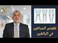 تقوس الساقين كيف يتم علاج تقوس الساقين في البالغين 