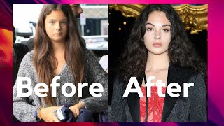 Deva Cassel (Monica Bellucci's Daughter) - Plastic Surgery Analysis