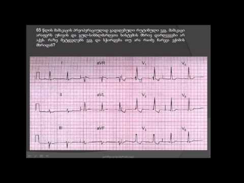 ვიდეო: თანდაყოლილი გულის დეფექტი (ებშტეინის ანომალია) კატებში