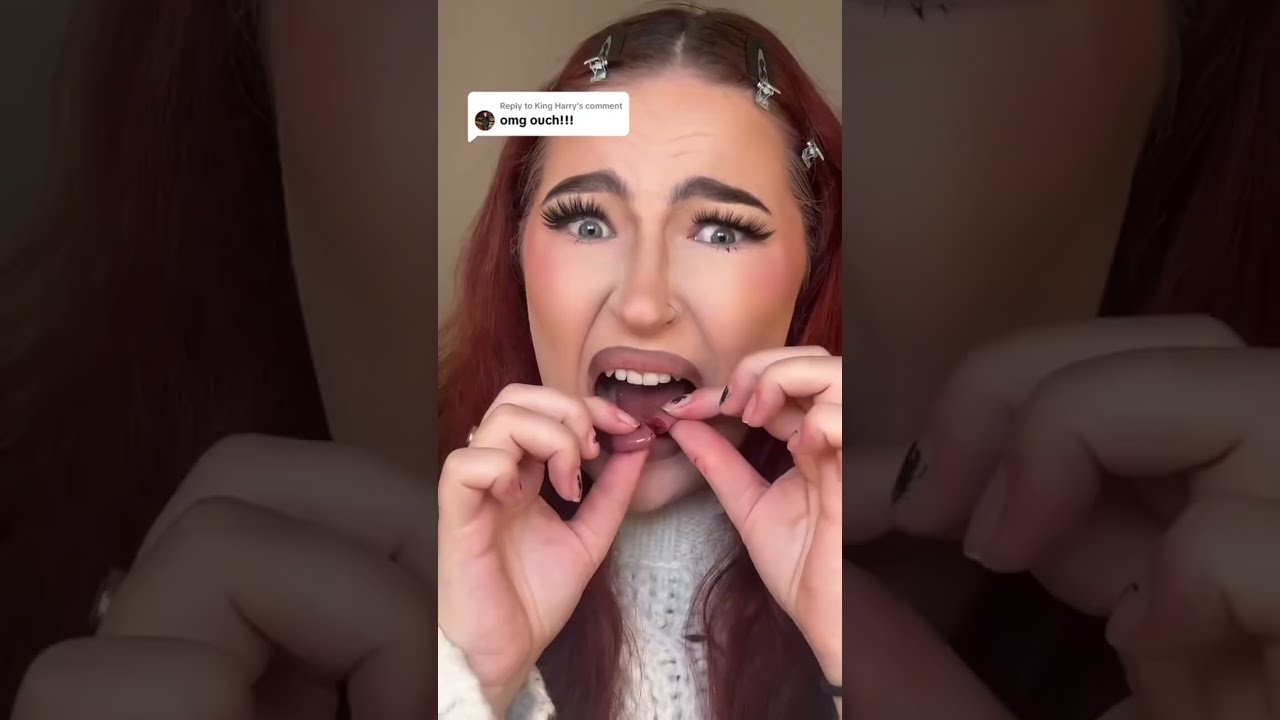 TONGUE PIERCING RIPPED OUT