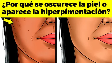 ¿Por qué mi cara se oscurece más que mi cuerpo?