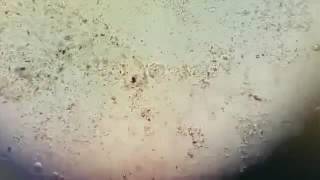 Trofozoito De Entamoeba Coli Created With