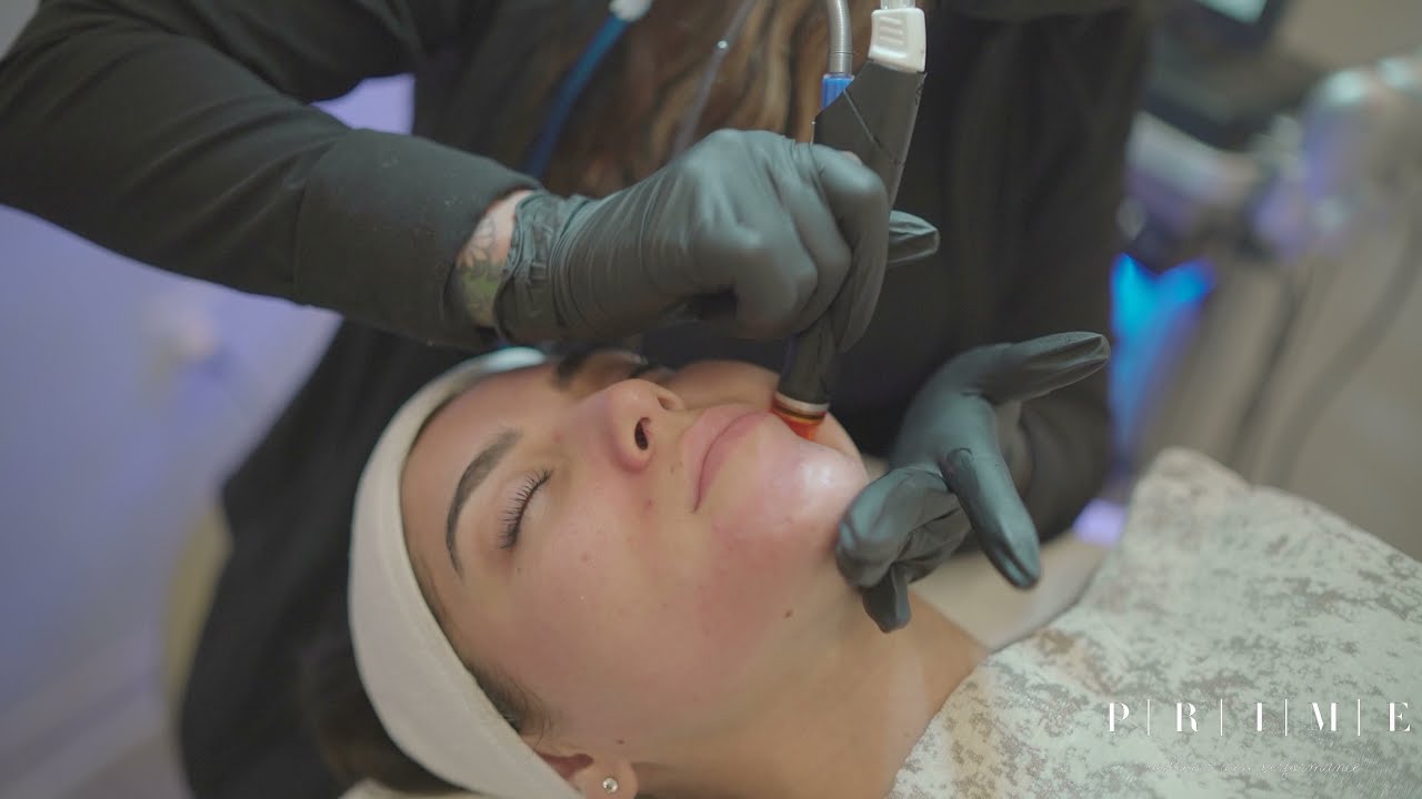 3 in 1 Treatment | Dermaplaning, Hydrafacial, and Chemical Peel | Prime Wellness and Performance