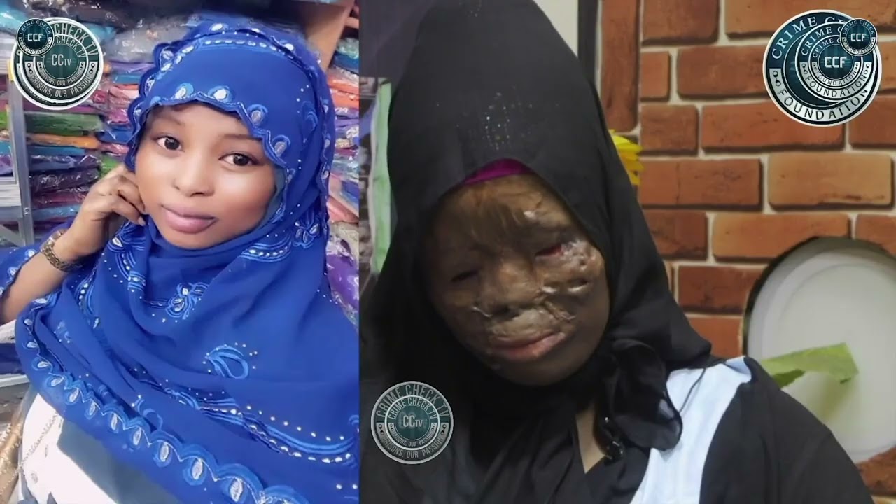 Мужчины преследуют женщину, которая перенесла 11 операций с применением кислоты.