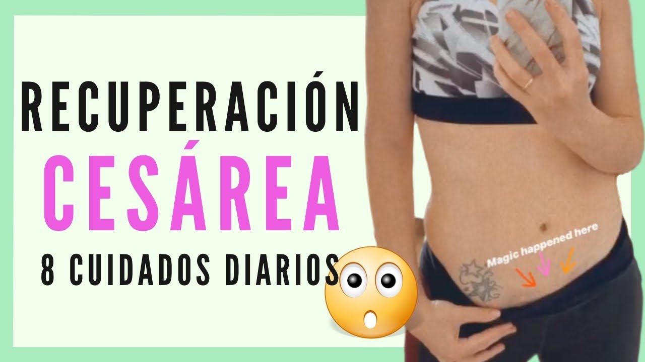 CESÁREA: Logra una Recuperación Rápida con estos Cuidados ⏰100% REAL 