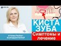 Киста зуба - симптомы, причины, диагностика и лечение кисты зуба!