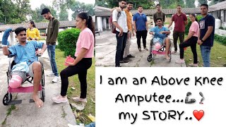 Above Knee Amputee || My story || Prosthetics || #ottobock #disability #prostheticleg #vlog #amv