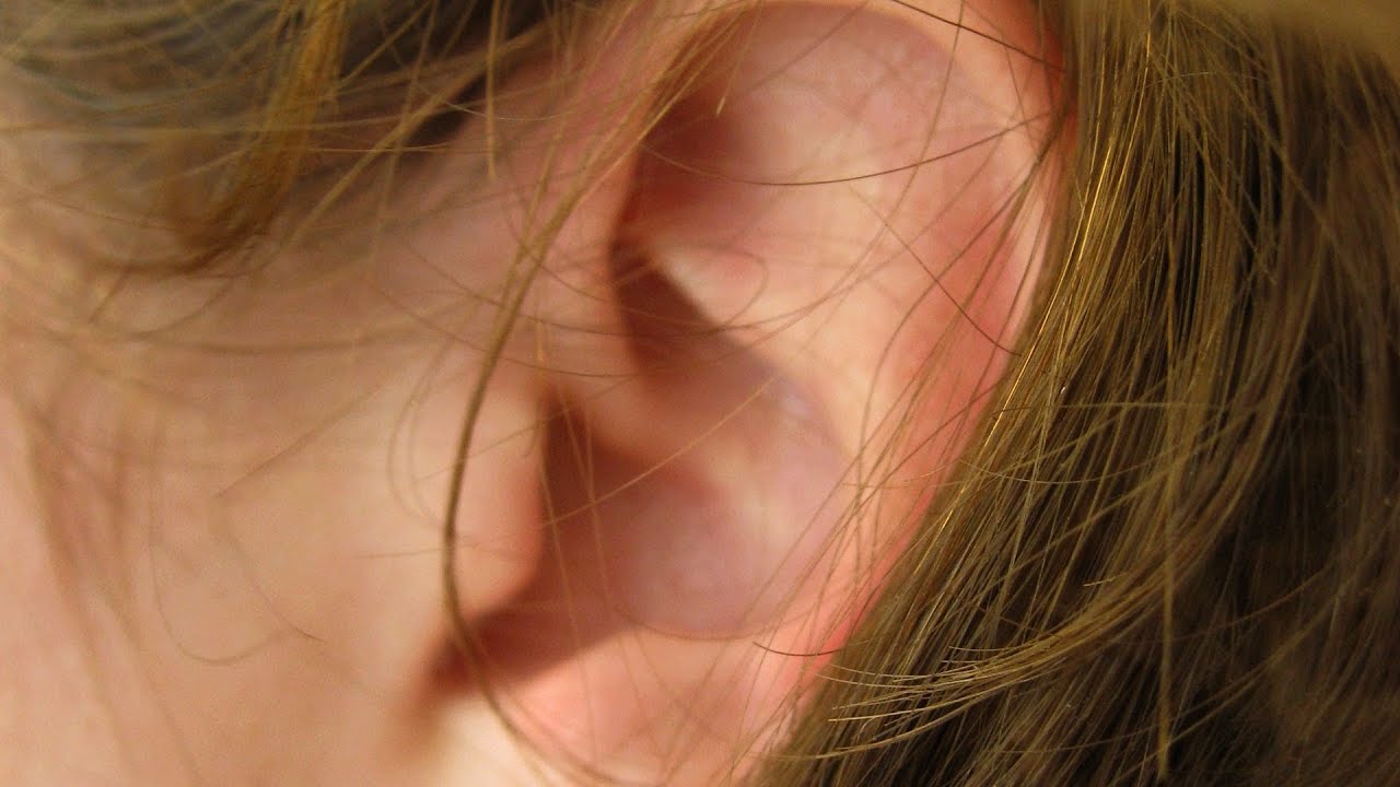 Are Ear Infections Contagious? | Ear Problems - YouTube Are Ear Infections Contagious? | Ear Problems - YouTube