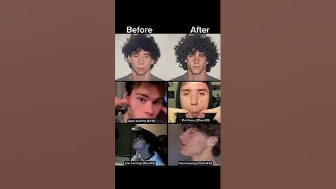 Hollow Cheeks Exercise #shorts #glowup