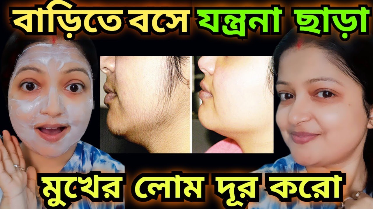মুখের লোম দূর করার উপায়/mukher lom dur korar upay/Facial hair removal