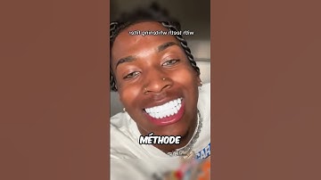 Comment blanchir toute vos dents 😨