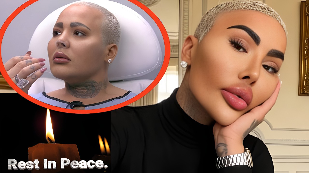 “Lip King” DEAD at 34?! 💔 Jordan James Parke Tragic Truth Finally Revealed 😭