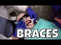 EMILY GETS BRACES!