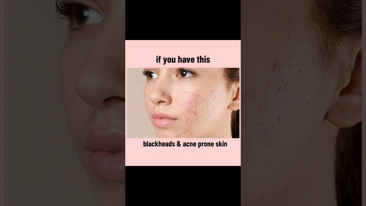 CeraVe Fixes Skin Problems | Tired of Products That Don’t Work? Try This! 