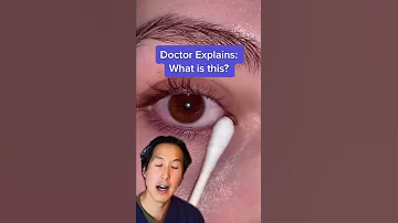 Doctor Reveals Mucus Fishing Syndrome Shorts Mucusfishing 