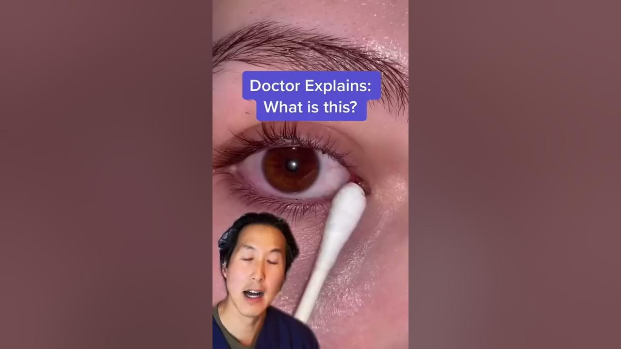 Doctor Reveals Mucus Fishing Syndrome! #shorts #mucusfishing