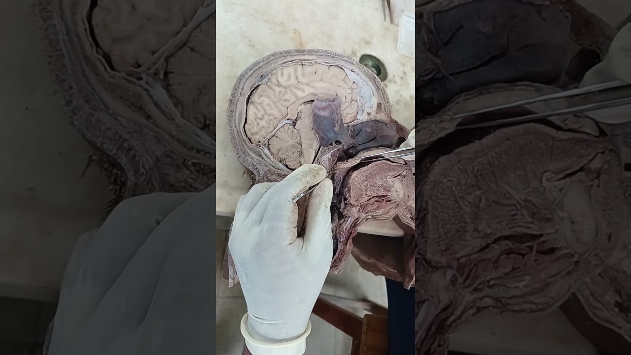 Mid sagittal section of Head & Neck ( Pharynx & lateral wall of nose) 2023